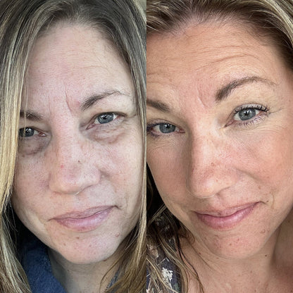 RevitalEyes Red Light + EMS Under-Eye Therapy